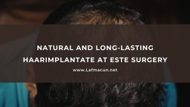 Natural and Long-Lasting haarimplantate at Este Surgery 12 Natural and Long-Lasting haarimplantate at Este Surgery
